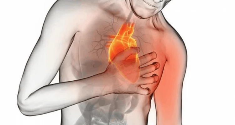 Imagen sobre "Riesgo Cardiovascular"